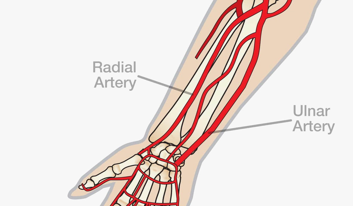Radial Artery
